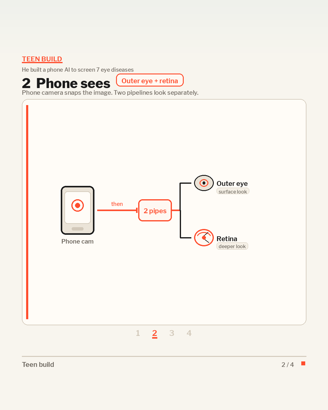 English slide showing phone camera with two EyeSpy AI pipelines for outer eye and retina
